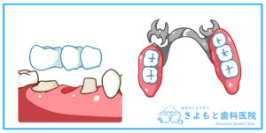 歯科医院,佐野市,きよもと歯科医院